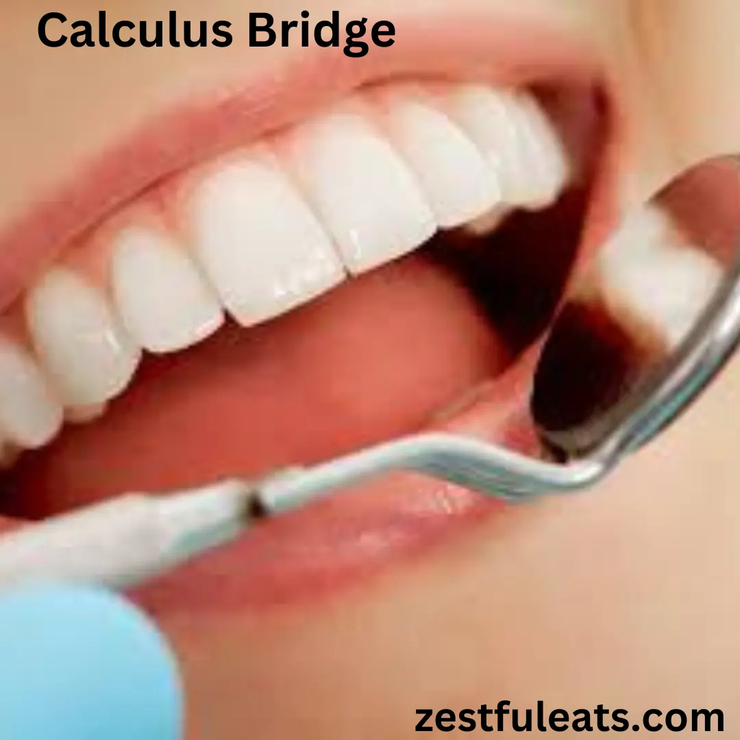 calculus bridge